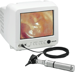 Welch Allyn® CompacVideo™ Otoscope 