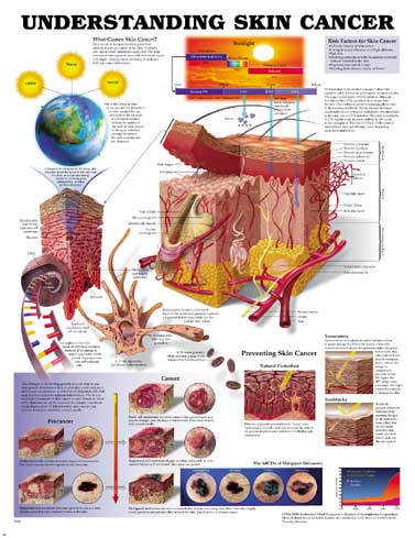 UNDERSTANDING SKIN CANCER ANATOMICAL CHART